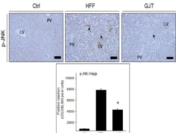 Fig. 4. The decrease of inflammation (p-IκB immunohistochemistry) in  hepatic  tissue  of  mice  with  NAFLD  by  GJ