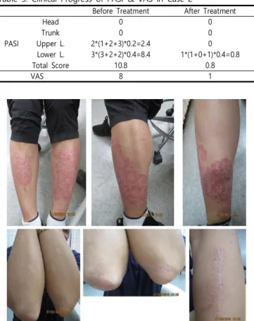 Fig.  5.  After  the  Baekho-tang Treatment  :  Case  2
