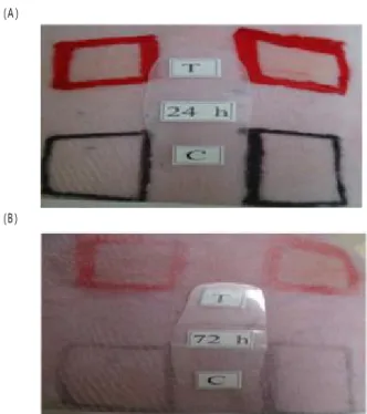 Fig .  6.  T h e   skin   su rface   o f  rab b it  a t  2 4  h (A )  an d   72   h (B ).