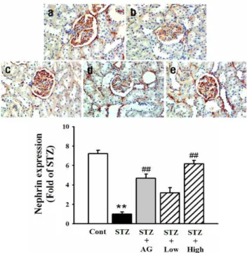 Fig. 4.  Effect  of  APV  on nephrin  protein expression level in the renal  glomerulus