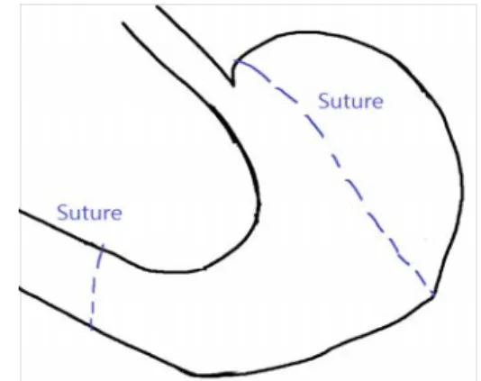 Fig.  1.  The  portion  of  ligation   3)  실험군  설정         실험동물은  아무런  처치를  하지  않은  정상군(Normal,  n=8), 개복한  후  위  부위를  묶지  않고  개복한  부위만  봉합한  군(Sham, n=8),  수술  전  2주일  동안  생리식염수를  투여하고  개복  수술시  위를  묶은  대조군(Control,  n=8),  수술  전  2주일  동안  유근피  추출물 280㎎/㎏