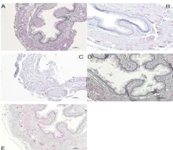 Fig. 10. The effects on stomach mucosa damage in reflux esophagitis  rat.  (x10)  A:  Normal  group(naive  rats)  B:  Sham  group(only  treated  ventrotomy  group)  C:  control  group(saline  administered  and  stomach  ligation  treated  group)  D:  T1  :