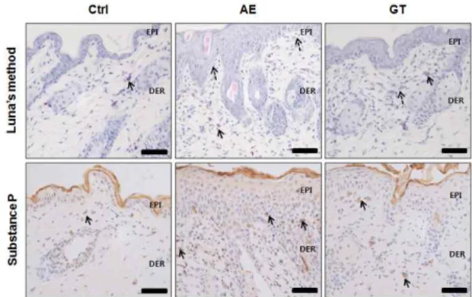 Fig. 4. The decrease in itching by Douchi-HTD.  The degranulated mast  cells  (dotted  line  arrow)  in  dermal  papillae  were  increased  in  AE  but  decreased in GT (Luna's method; full line arrow, granulated mast cell; bar  size, 50  ㎛)