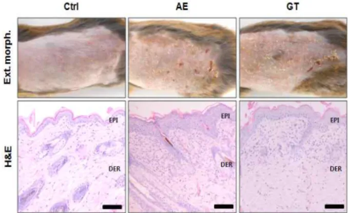 Fig.  6.  Image  analysis  of  immunohistochemistry.  Abbreviation:  #,  p<0.001  compared  with  AE.