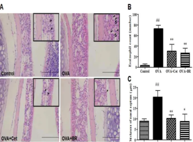 Fig.  4.  The  histological  changes  of  nasal  mucosa  and  infiltration  of  eosinophil  in  allergic  rhinitis  model