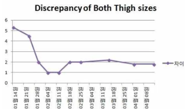 Fig. 3. The discrepancy of both thigh sizes.  The discrepancy of both thi gh sizes was 5 cm when the patient was in hospital first day, 2015/01/14