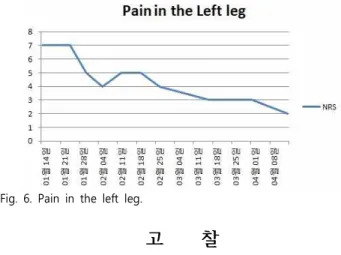 Fig.  6.  Pain  in  the  left  leg. 고        찰         심부  정맥혈전증은  하지의  통증,  저림,  부종,  피부색변화  등의  증상으로도  충분히  고통스러울  수  있는  질환이지만,  급성적으로  응 급상황을  유발할  수  있는  폐색전(Pulmonary  Embolism)으로의  이 행  위험성  때문에  특히나  더  중요하게  인식하고  치료해야  하는  질 환이다