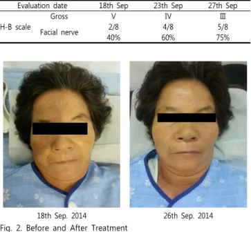 Fig.  2.  Before  and  After  Treatment 