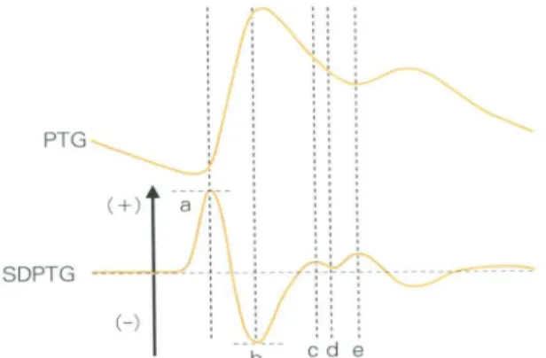 Fig.  1.  Waveforms  of  the  finger  photoplethysmogram(PTG)  and  the  second  derivative  of  the  finger  photoplethysmogram(SDPTG)