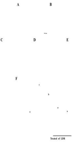 Fig.  3.  Effect  of  lactic  acid  bacteria-fermented  Dioscoreae  Rhizoma  powder (LDR) on histological adipocyte size in obesity model induced  by  a  high-fat  diet  (100×  magnification)