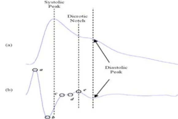 Fig . 1. A sch em a o f (a) the fin g er p h o to p leth ysm o g ram (P TG ) and (b ) the seco nd d erivative w ave o f p ho to p lethysm o g ram (S D P T G )