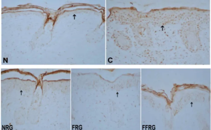 Fig.  3.  Immunohistological  changes  of  MMP-9  in  skin  of  SKH-1  mice  exposed  to  4  weeks  of  UVB  irradiated  experimental  groups(C,  NRG,  FRG,  FFRG)  and  non-irradiated  normal  group(N)(MMP-9  immunohistochemical  stain,  x200)