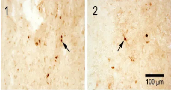 Fig. 6. Bax immuno-labeled representative sections of the ICH-induced rat brain. Section 1, Control; Section 2, Sample