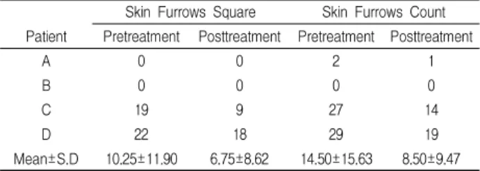 Table 1. Analysis of Skin Furrows Square and Count on R1 Area Skin Furrows Square Skin Furrows Count Patient Pretreatment Posttreatment Pretreatment Posttreatment