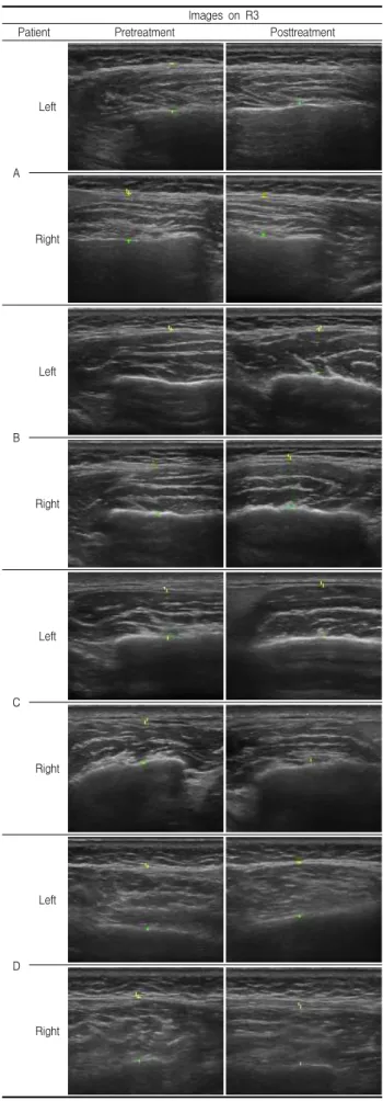 Fig. 1. Ultrasonographic images on R3