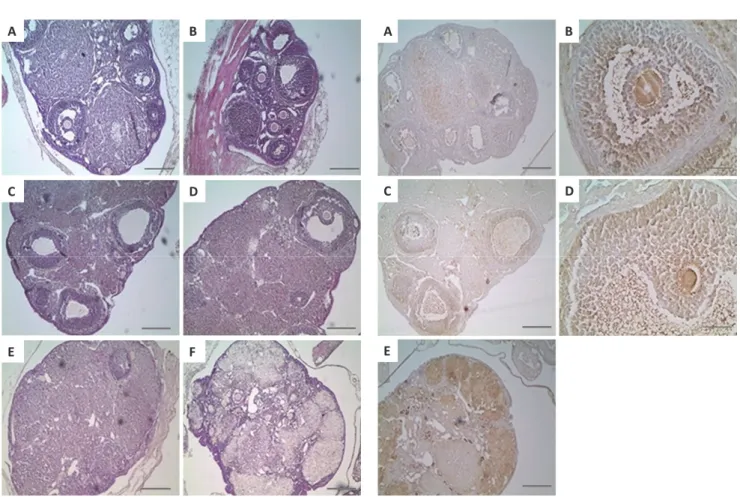 Figure 3.   The  distribution  of  LHR  positive  cells  on  the  ovarian  follicles  in  young  (A  and  B),  middle  (C  and  D)  and  old  (E  and  F)  aged  mice