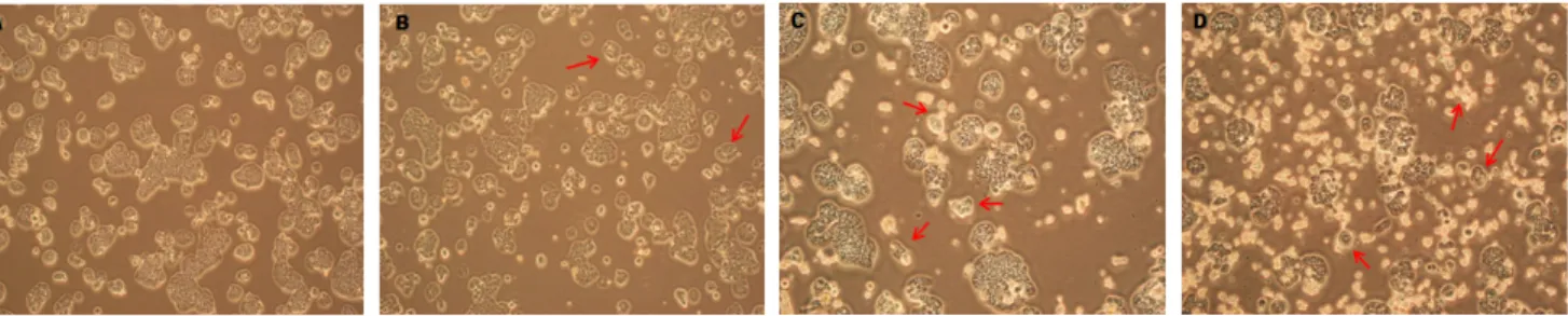 Fig.  2.  Effects  of  Nelumbo  nucifera  root  extract  on  cell  viability  in  HT-29  and  HCT116  cells