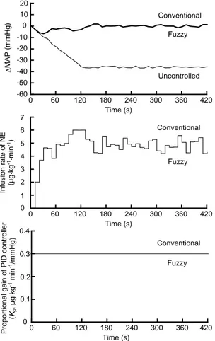 Fig. 3 Fuzzy or conventional PID control under the twice  response of the expected MAP during acute hypotension 