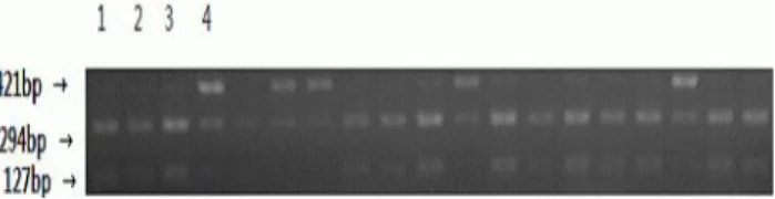 Fig.  1.  Agarose  gel  electrophoretic  result  of  leptin  recep- recep-tor  gene  after  PCR  amplication  and  digestion  with  Msp  I  restriction  enzyme
