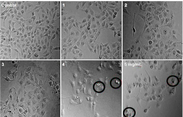 Fig.  1.  The  effect  of  Angelica  keiskei  extract  on  cell  mor- mor-phology  shown  by  visual  inspection  after  48h  exposure  to  various  concentrations  in  human  breast  cancer  MDA-MB-  231  cells.