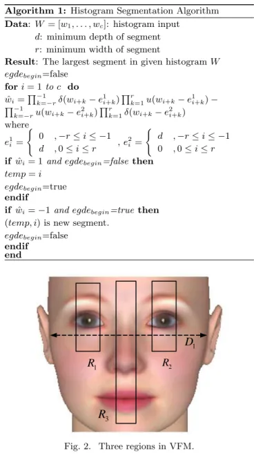Fig. 2. Three regions in VFM.