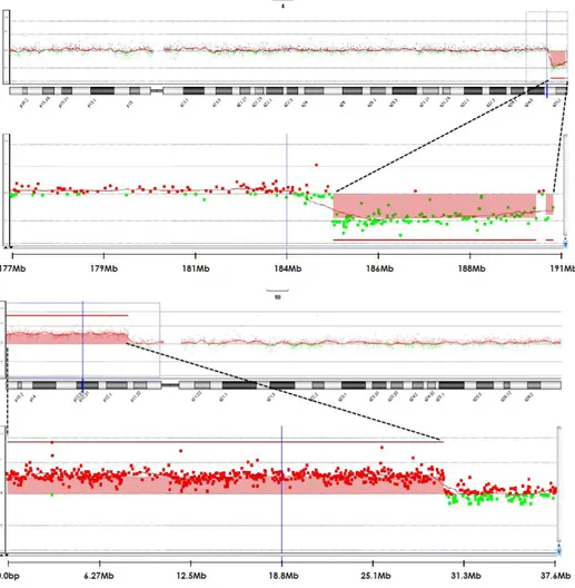 Fig. 3.  Microarray report;arr[GRCh37] 4q35.1q35.2(185274461_190469337)x1,10p 15.3p11.23(148206_29975521)x3 pat