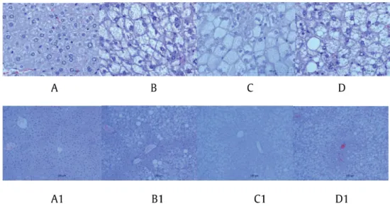 Fig. 6. Effect of 25-OH-PPT on liver pathology in DB/DB mice; A: blank control group 40X, A1: 10X; B: model group (DB/DB) 40X, B1: 10X; C: 25-OH-PPT group 40X, C1: 10X; D: