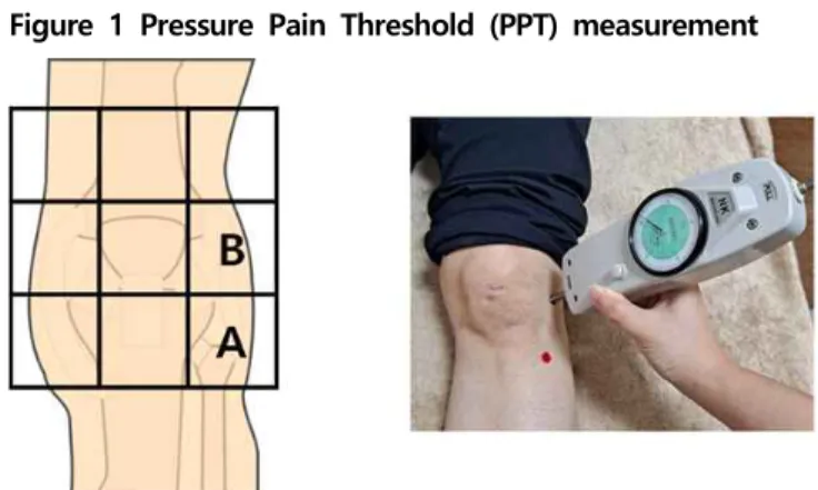 Figure  1  Pressure  Pain  Threshold  (PPT)  measurement