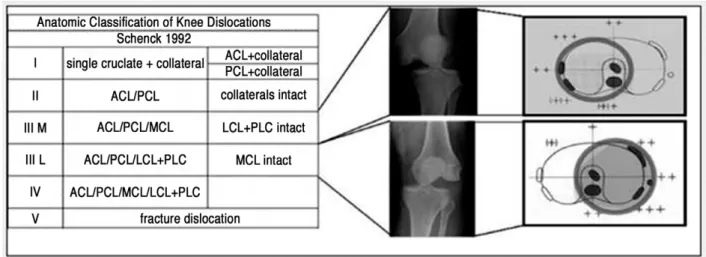 Fig. 2. Modified Schenck classification 25) . An appended uppercase  “C”indicates circulatory injury, an “N”denotes neurologic damage.