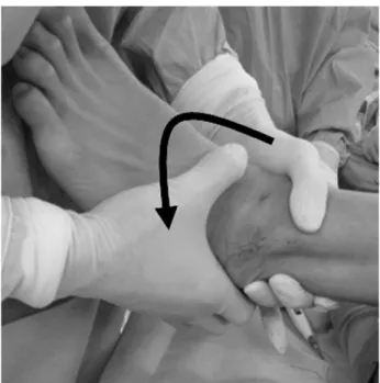Fig. 2. (A) Arthroscopic finding shows the deltoid ligament chronic tear. (B) Arthroscopic finding shows the widening of the medial