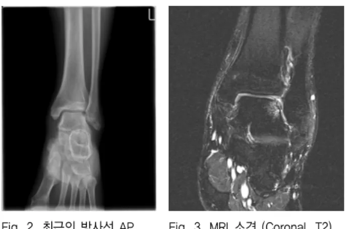 Fig. 2. 최근의 방사선 AP