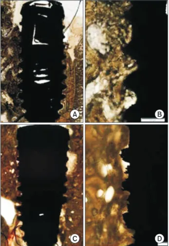 Fig. 1. Resorbable blast media surface fixture light micrographs  in the 2-week (A, B) and 4-week (C, D) groups