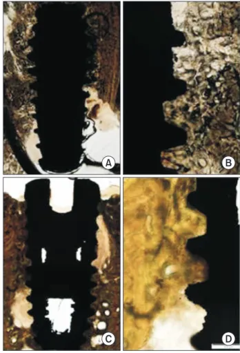 Fig. 4. The sand blasting and acid etching surface fixture light  micrographs in the 2-week (A, B) and 4-week (C, D) groups
