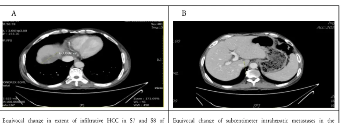 Figure  1.  Abdomen  computed  tomography  (2020.08.05.) 