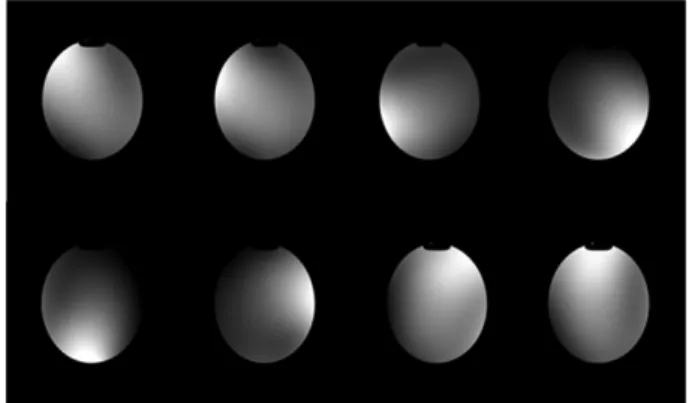 Fig. 1. Array coil systems are collections of small surface coils whose signals may be combined but generally feed into independent receiver circuitry.