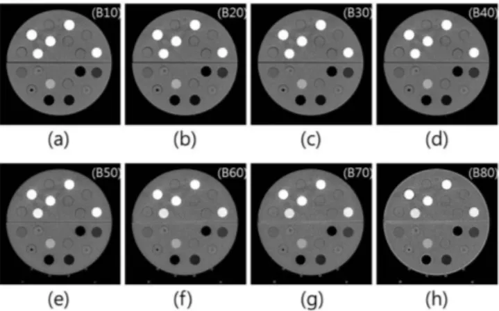 Fig. 8. The image of the phantom reconstructed with kernels. Eight images were reconstructed with various kernels as  fol-lows: (a) very smooth, (b) smooth, (c) medium smooth, (d) medium, (e) medium sharp, (f) sharp, (g) very sharp, (h) ultra sharp.