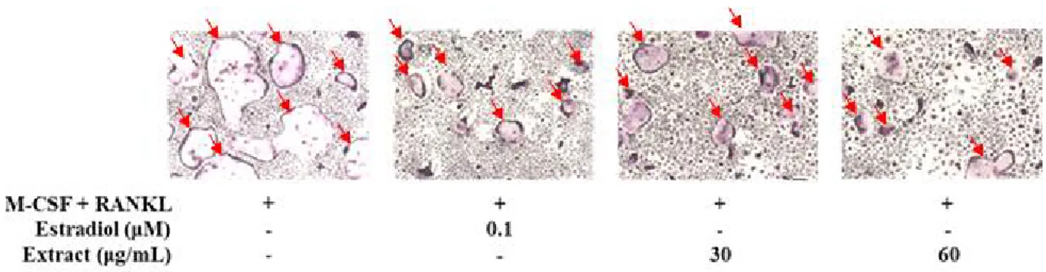 Figure  3.  Anti-osteoclastogenesis  activity  of  Myelophycus  simplex  extract.  BMMs  were  incubated  with  α-MEM  supplemented 