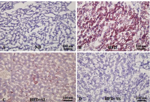 Fig. 2.  Histopathological effect of feeding Sparassis latifolia in rat livers stained with oil red O at 400× magnification (A-D)