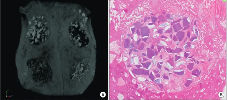 Fig. 1. A. Microcomputed tomography image of an  en bloc  rabbit calvarial defect. Top left: DDM, top right: DDM, bottom left: ABB/rh- ABB/rh-BMP-2, bottom right: DDM/rhBMP-2