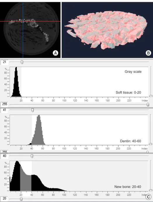 Fig. 2. A. Microcomputed tomography  image of calvarial defect, cross  sec-tion at two weeks after demineralized  dentin matrix (DDM) implantation