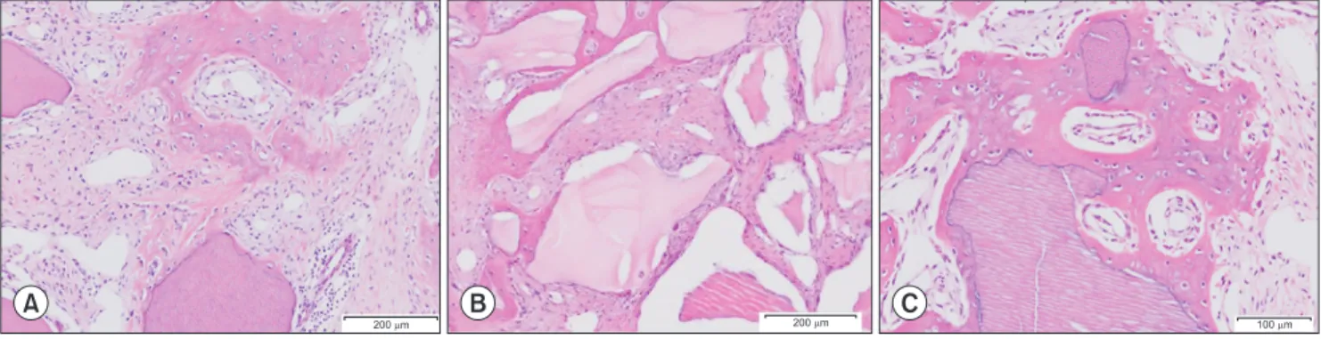 Fig. 3. A. DDM at two weeks (H&amp;E staining, ×100). New bone was formed and migrated from the bone defect margin that has abundant  osteocytes and blood vessels