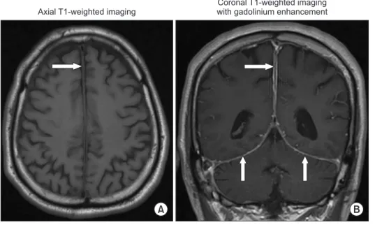 Figure 1.  Magnetic resonance imaging  of a patient with diffuse hypertrophic  pachymeningeal tuberculosis (before  treatment)