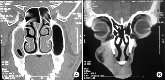 Fig. 3. Placement of intraoral vestibular incision to gain access to  the lesion.