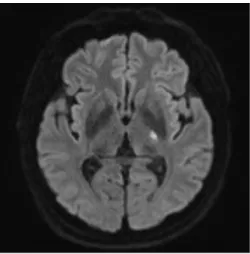 Fig.  1.  Brain  MRI  (2020.08.03).한 한방 치료를 병행하여 우측 편마비, 보행 장애 증상이 유의미하게  호전된  결과를  얻었기에  보고하는  바이다.증        례1