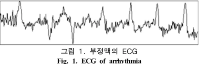 그림  1.  부정맥의  ECG