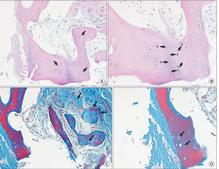 Fig. 5. The section in 6-months was stained with H&amp;E staining (A: ×200, B: ×400) and Masson’s trichorme staining (C: ×200, D: 400)