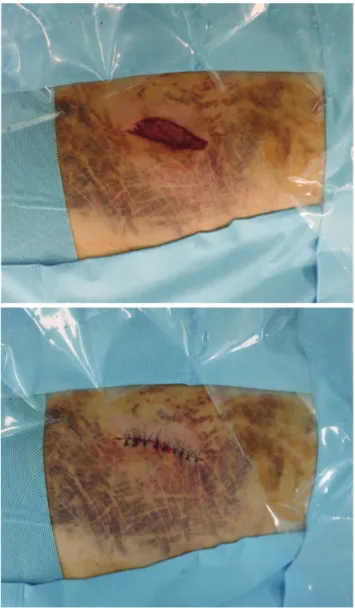 Fig. 5.  Two weeks after the operation, the previous skin color had im- im-proved.