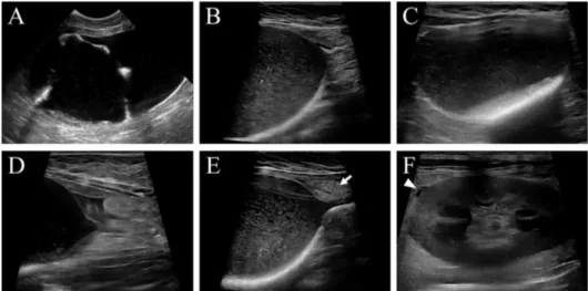 Fig 1. Ultrasonographic findings in cats with FLUTD. Suspended linear strand lined along bladder wall (A), severe urine echogenicity and sediment (B), hyperechoic cystolith with acoustic shadowing (C), and pericystic effusion (D) are noted