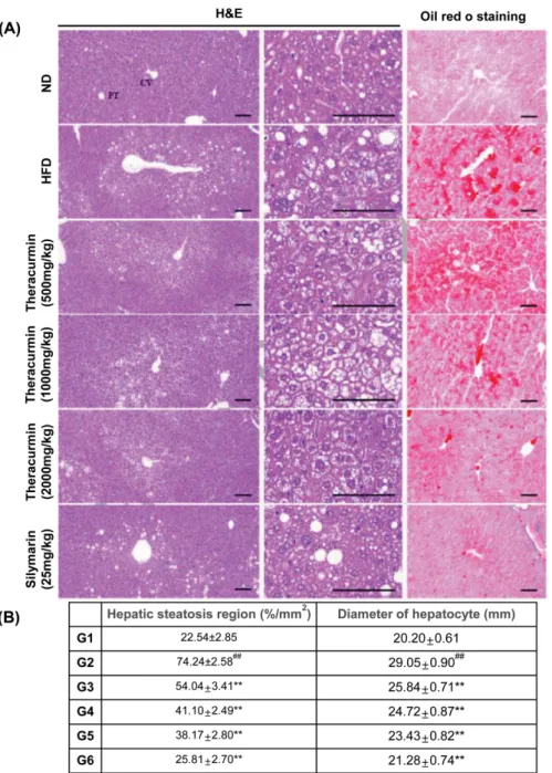 Fig. 1. Effects of theracurmin on hepatic lipid accumulation in mice fed  with  HFD.  (A)  Liver  sections  were  stained  with  H&amp;E  or  oil-