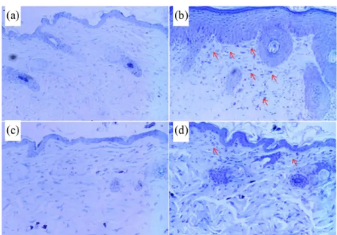 Fig. 6. Histological status of the skin stained with toluidine blue of dorsal skin group in atopic dermatitis-like NC/Nga mice induced by Mite extract.